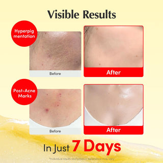 EQQUALBERRY Vitamin Illuminating Cream 50ml