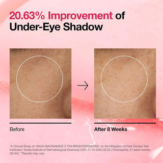 Anua Niacinamide 5 TXA Brightening Pad 60 Pads