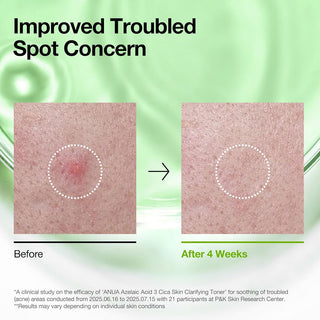 Anua Azelaic Acid 3 Cica Skin Clarifying Toner 250ml