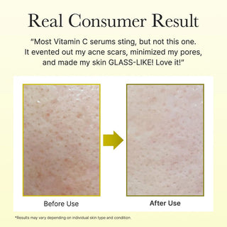 Arencia Vitamin C Booster Shot 30ml