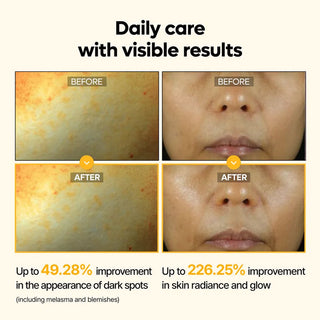 Dr.Melaxin Kojic Acid Turmeric Serum 50ml