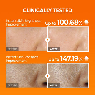 Dr.Melaxin Peel Shot Exfoliating Mela-CE Ferulic Serum 80ml
