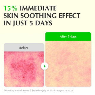 EQQUALBERRY Aloe PDRN Calming Serum 30ml