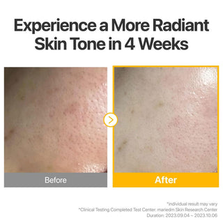 Numbuzin No.5+ Glutathione Vitamin Concentrated Mask (Single Sheet)