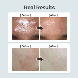 Numbuzin No.1 Pure-Full Calming Herb Toner 300ml