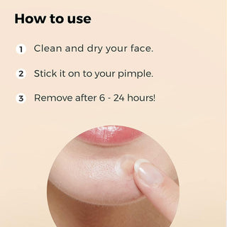 Cosrx Master Patch Basic - 36 Patches