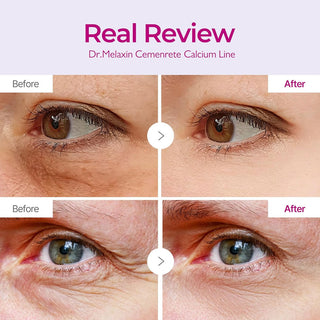 Dr.Melaxin Cemenrete Calcium Volume Eye Patch - 60ea