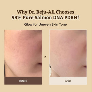 Dr. Reju-All Advanced PDRN Rejuvenating Cream 20ml
