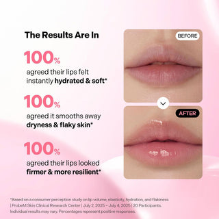 Torriden Cellmazing Lip Essence 11ml