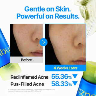 Numbuzin Zero Blemish Clarifying 2% Sulfur Cleansing Foam 150ml