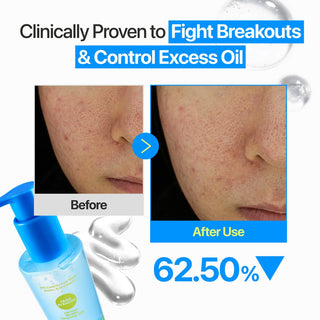 Numbuzin Zero Blemish Oil-Free Micellar Cleansing Jelly 200ml