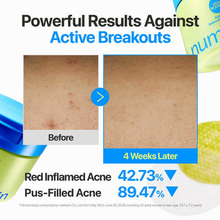 Numbuzin Zero Blemish Azela Cica Balancing Dual Pads, 60 Pads